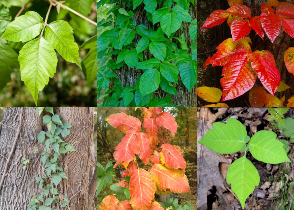 Poison Ivy Rash in Children